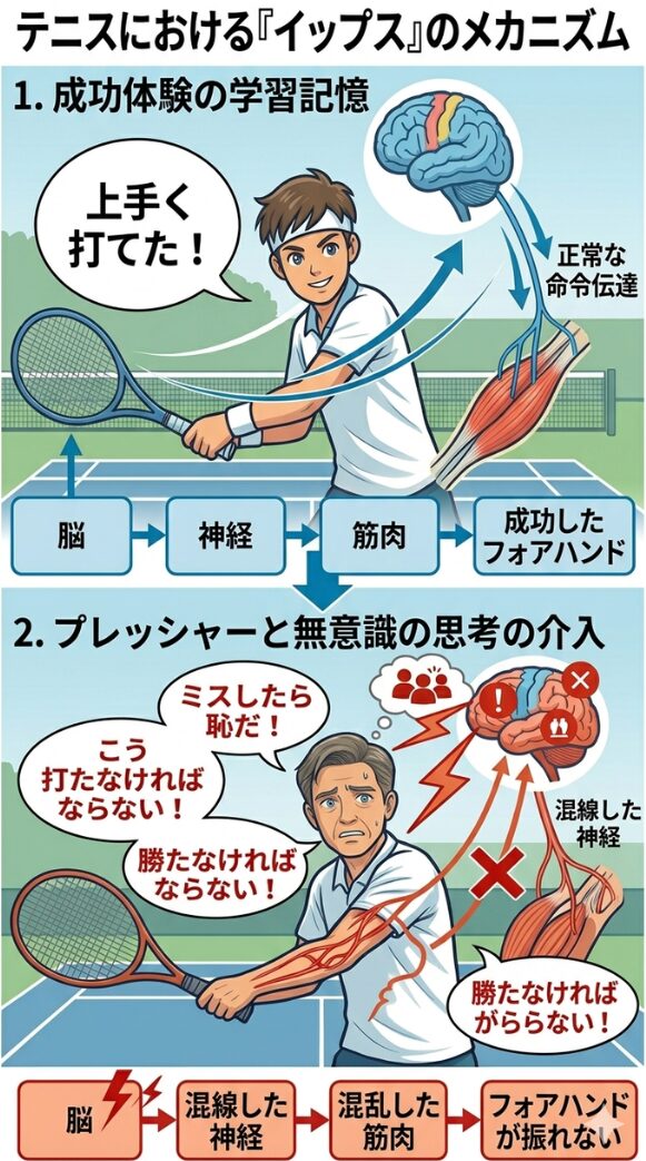 テニスイップスの原因解説画像