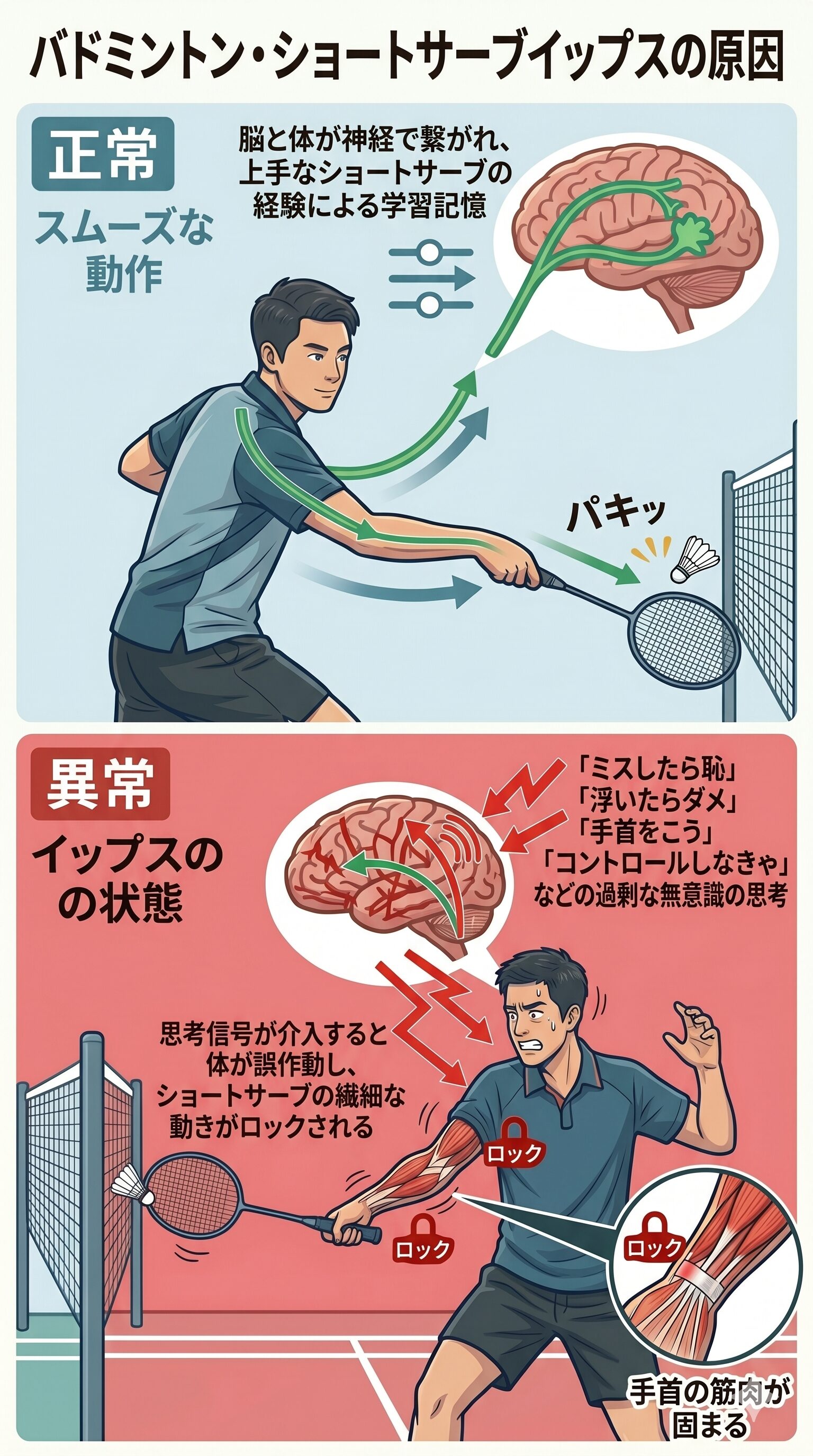 バドミントンイップス原因図解