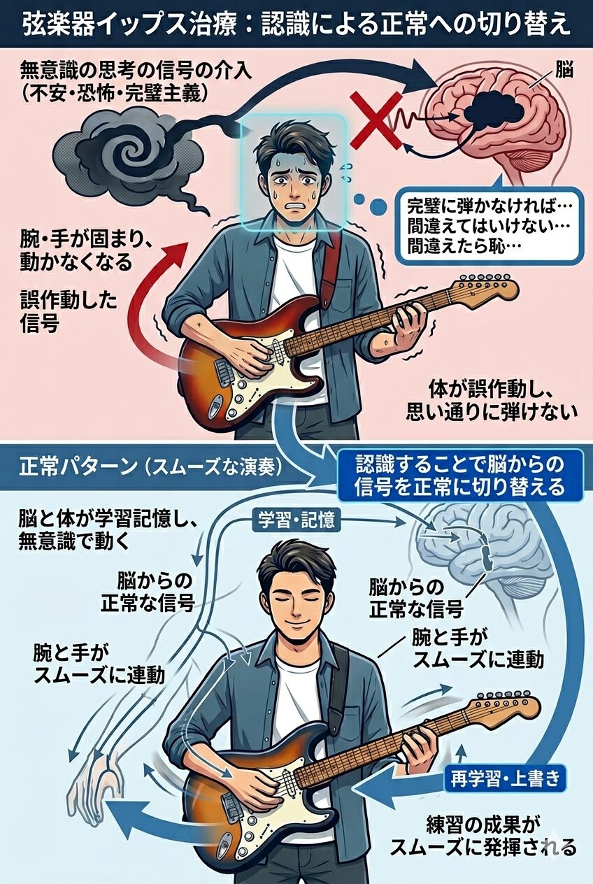 弦楽器イップス治療メカニズム図解