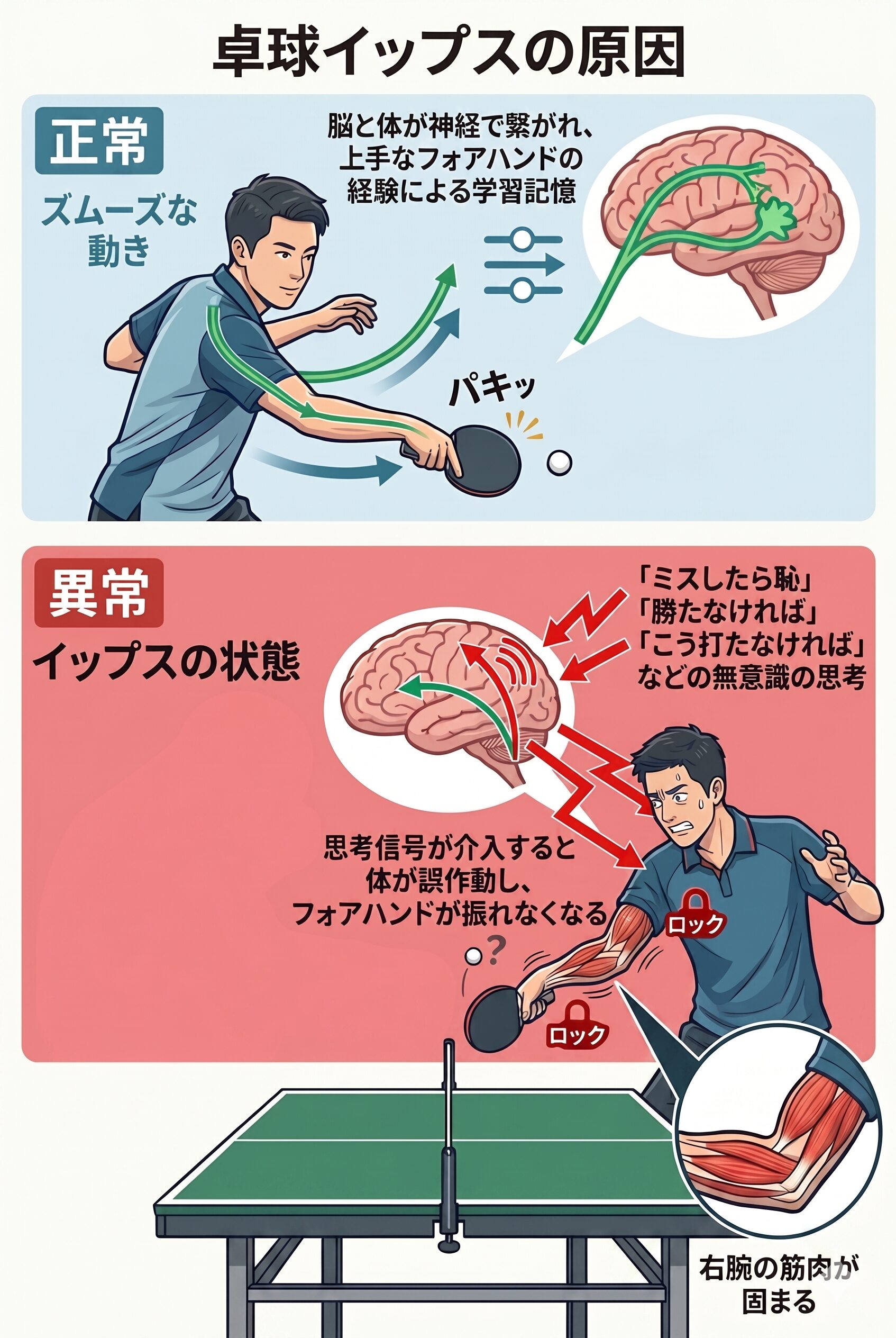 卓球イップス原因図解